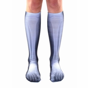 X-Ray