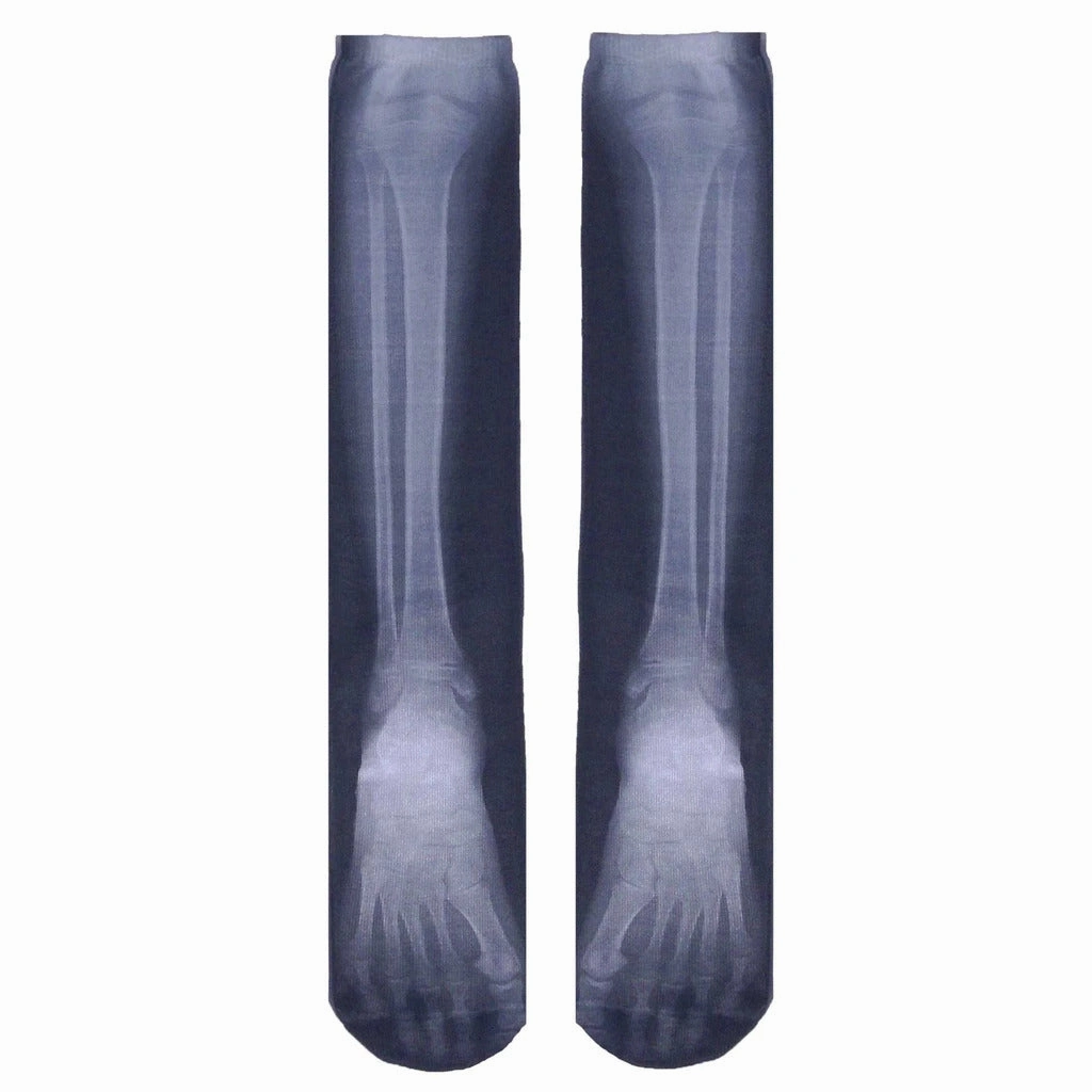 X-Ray